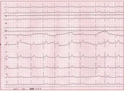 吃瓜网山东心电图事件,揭秘医疗争议背后的真相