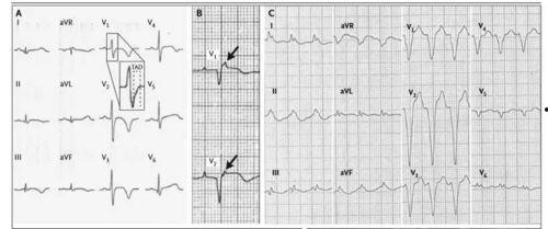 吃瓜网山东心电图事件,揭秘医疗争议背后的真相